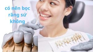 có nên bọc răng sứ không