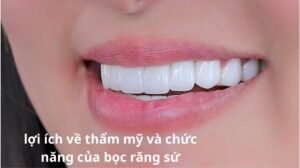lợi ích về thẩm mỹ và chức năng của bọc răng sứ