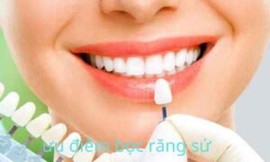 ưu điểm bọc răng sứ