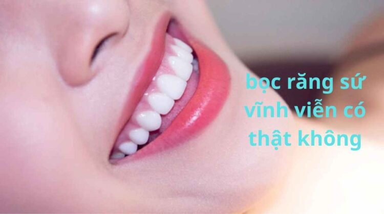 bọc răng sứ vĩnh viễn có thật không